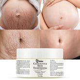 7better Stretch Mark Cream Pregnancy bottle demonstrates hydrating formula for stretch-prone skin.