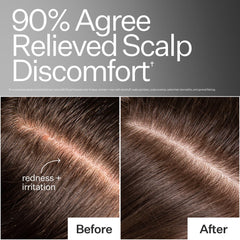 ACT+ ACRE Microbiome Cooling Scalp Serum on fingertips ready for massage