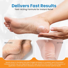 ActivLife Revitaderm exfoliating brush included for gentle buffing.