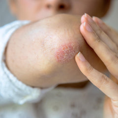 Adamia Therapeutic Repair Lotion packaging close-up emphasizes fragrance-free, paraben-free formula.