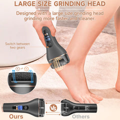 AdamPark Callus Remover grinding heads visible for versatile dead-skin removal
