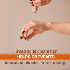 Adult Acnomel cream texture close-up showing lightweight, blendable tint.