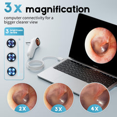Aertnelz Otoscope 1080P HD imaging reveals fine detail in ears nose and skin