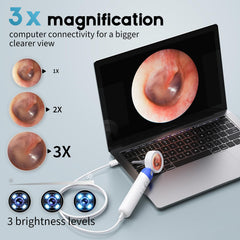 Aertnelz Otoscope ergonomic grip for comfortable extended use.