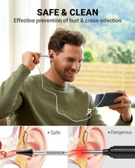Anykit otoscope 3-9mm camera probe captures detailed canal shots for wax assessment.