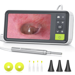 Anykit otoscope gyroscope view demonstrates stable orientation for clear ear inspection.