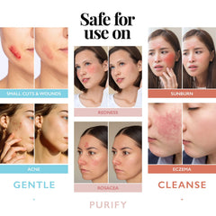 Person using Aquia face mist to calm skin and reduce visible redness