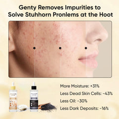 Art anime Peel Shot Glow pore-minimizing close-up hints at a matte finish