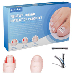 Asinkiher titanium alloy ingrown toenail corrector with 0-59 inch size for precise correction