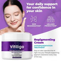 Aura Vitamins Vitiligo Cream in use on skin for daily care