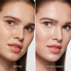 Aurivoy dark spot serum swatches demonstrate shade range and fading potential