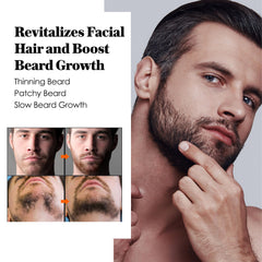 AVITAPURE Minoxidil beard oil application shows nourishing touch and hydration