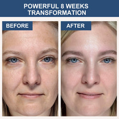 AVJONE Collagen Mask hydrogel texture close-up emphasizing absorption potential