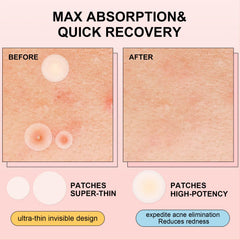AVJONE nighttime patch on skin provides overnight support with added ingredients.