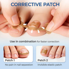 awrose i-shaped correction stickers 20pcs ready to support breathable, discreet toe protection