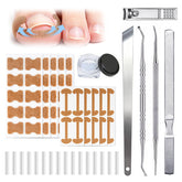 awrose ingrown toenail corrector set packaging shows all-in-one kit for easy at-home nail care