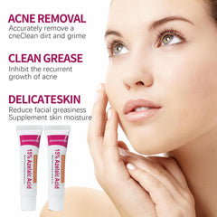 Azelaic Acid Acne Cream close-up bottle signals reliable formula for clearer-looking skin.