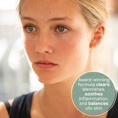 Balance Me Congested Skin Serum texture swatch shows lightweight formula for oily and sensitive skin.
