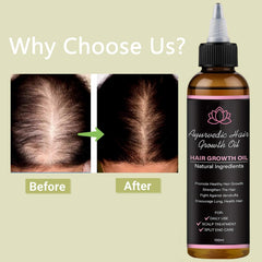 BALPPRD Lifewitqueenp applying oil demonstrates scalp nourishment and soothing care