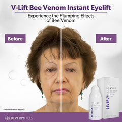 BEVERLY HILLS V-LIFT packaging box front highlights premium eye care.