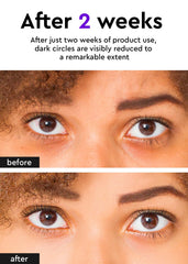 BE+WANTS Bewants under eye cream vegan collagen closeup highlights hydration and elasticity.