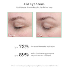 BIOEFFECT EGF Eye Serum hydration boost improves skin density around the eye contour.