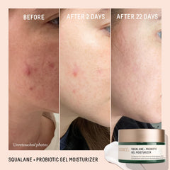 BIOSSANCE gel texture closeup illustrating refreshing, non-greasy feel for sensitive skin.