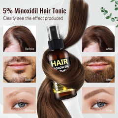 BLISSMATE women regrowth-application demonstrates daily-use routine on the scalp.