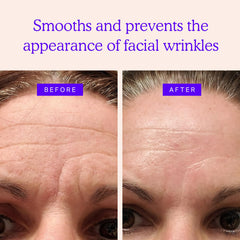BLUMBODY triangle forehead patch application close-up for overnight use