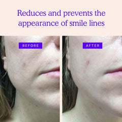 BLUMBODY face patches overnight application demonstrates skin-friendly non-transdermal use