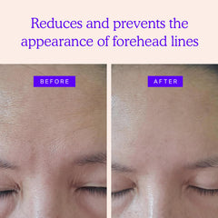 BLUMBODY forehead wrinkle patches on skin show thin, discreet wear.