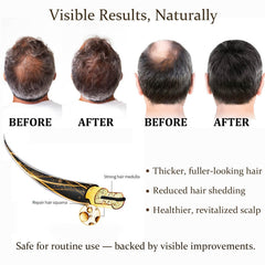 Boaccy Hair Regrowth System packaging box highlights key ingredients