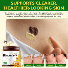 BOIUOITI Bee Venom Comprehensive Cream applied on face shows smoothing and even-toned look.