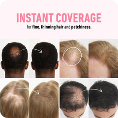 Boldify Hair Fibers crown coverage demonstrates natural fill around the scalp