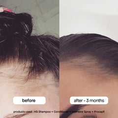 BONDIBOOST mist on hand showing lightweight texture and quick absorption