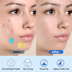 Breiboz pimple patches with tea tree oil provide calming, pore-tightening skin support.