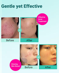 BRING GREEN Tea Tree Cica Cream hydrates without greasiness