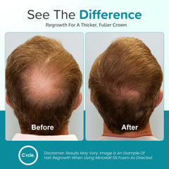 Close-up of C'rcle Minoxidil foam texture for comfortable use
