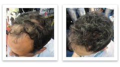 Caboki bald-spot elimination visuals show seamless blend with surrounding hair.