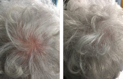 Caboki hair fiber conceals bald spot for a fuller-looking scalp