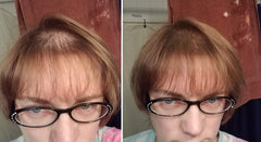 Caboki thinning hair before shot highlights sparse strands and visible scalp.