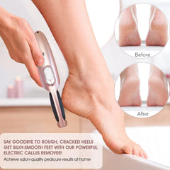 Care me fast-charge battery powers up in 2 hours for up to 60 minutes of use.