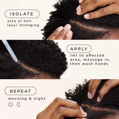 Goddess Strength dropper applying minoxidil to thinning scalp for targeted regrowth.