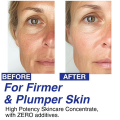 CELDYQUE Volufiline jawline contouring action hints at sharper definition.