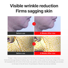 Close-up of skin after use with Centellian24 Madeca Cream Time Reverse