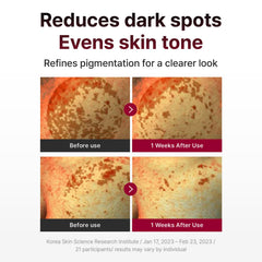 CENTELLIAN 24 Madeca Mela Capture Ampoule Pad application detail highlighting melanin-targeting concept.