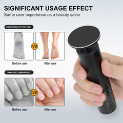 Cesekao Obsidian LED display highlights speed levels for precise callus care.