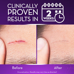 Cicatricure Advanced Scar Gel packaging highlighting Regenerare Complex ingredient