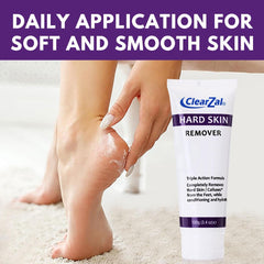 Clearzal Foot Cream sole closeup, hydration targets rough areas