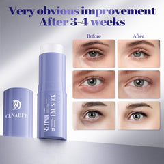 CLNABFR eye stick may help reduce dark circles appearance.